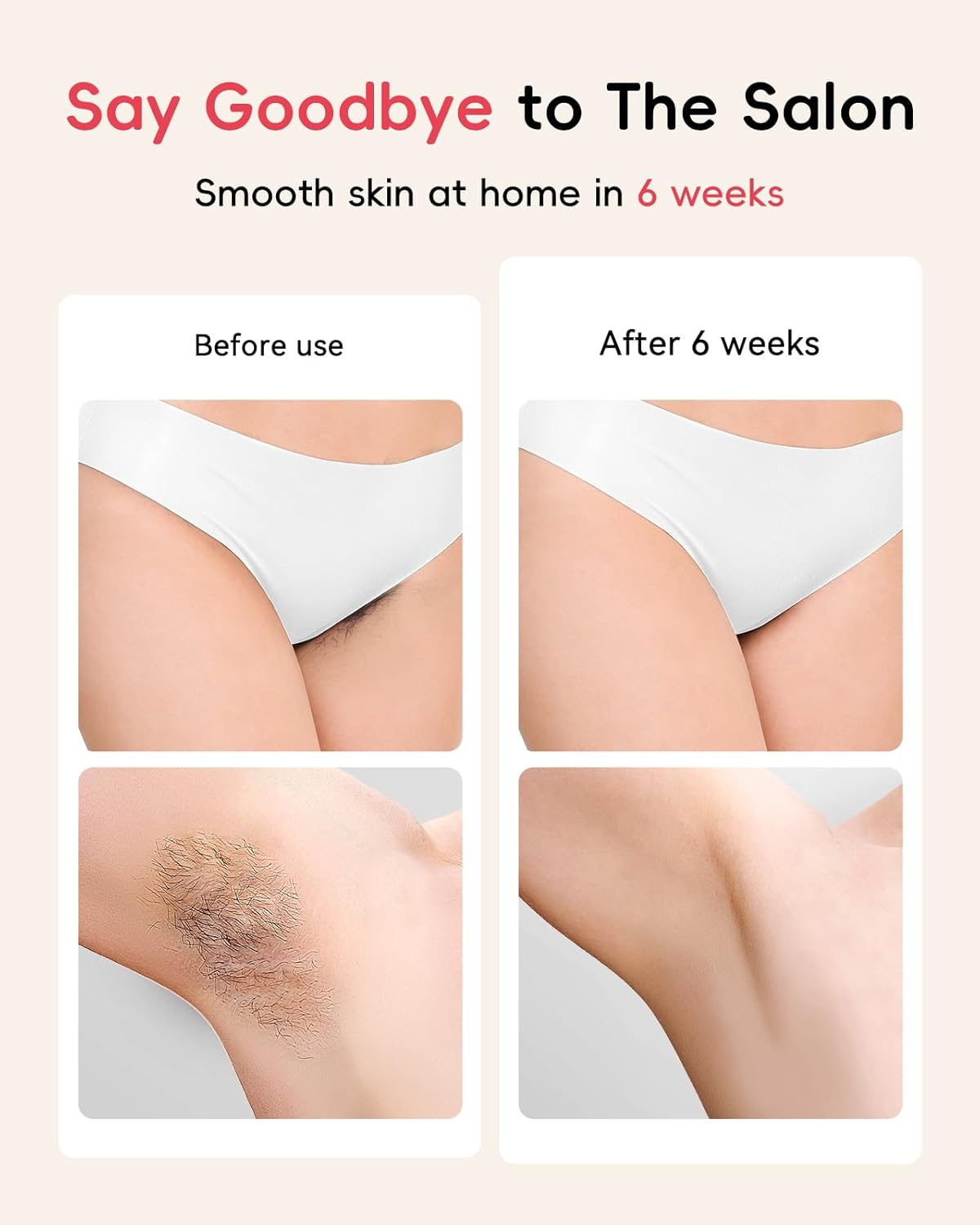 Haarlosy IPL Laser Hair Removal Device for Women and Men, Painless and Long Lasting Result, IGBT at Home IPL Laser Hair Remover Machine for Bikini Line Face Armpit Body, Pale Yellow
