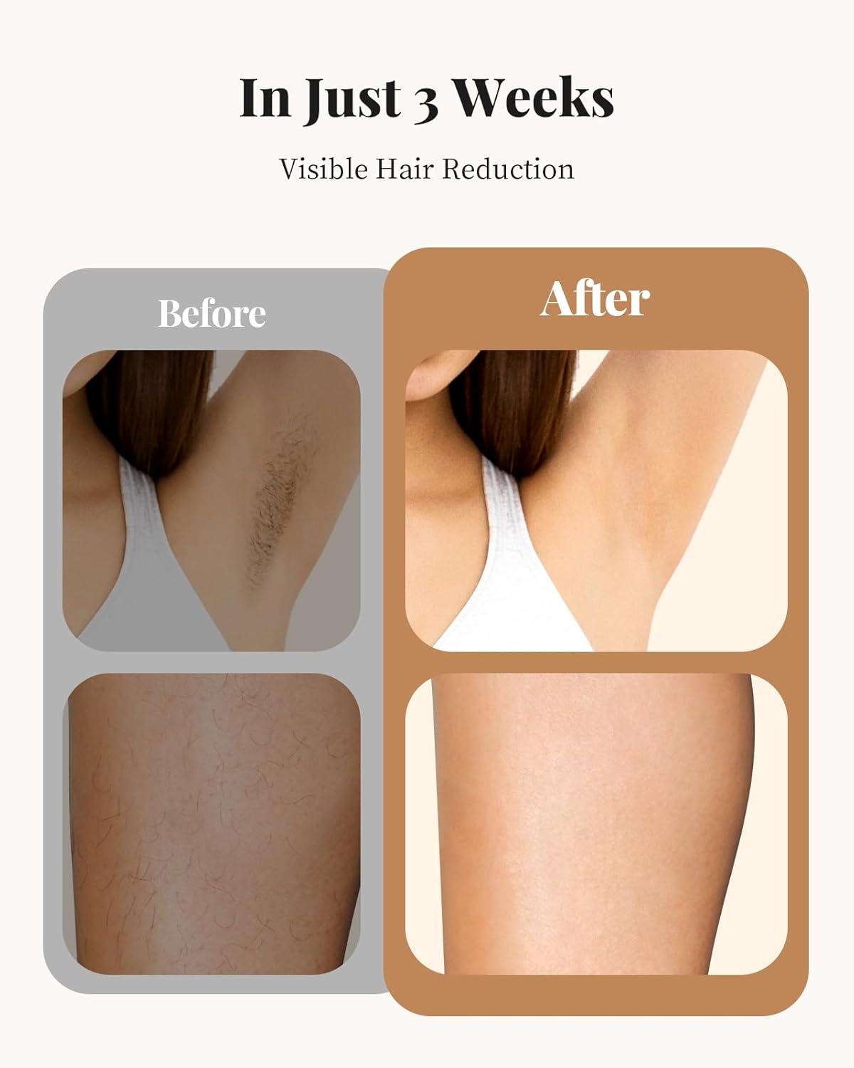 Haarlosy IPL Laser Hair Removal Device for Women and Men