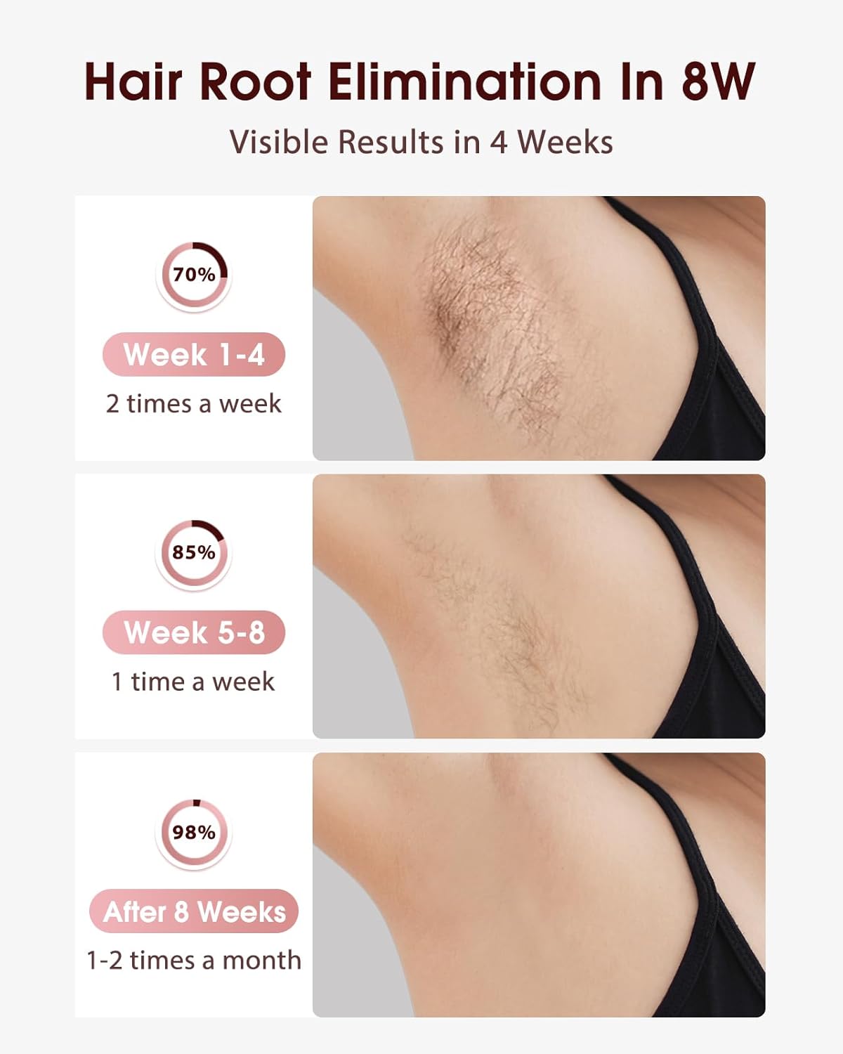 LYSMOSKI Laser Hair Removal, IPL Hair Removal with Ice-Cooling System