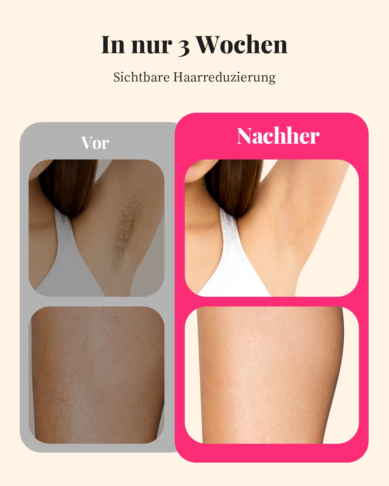Haarlosy IPL Geräte Haarentfernung Laser Haarentfernungsgerät Frauen Männer