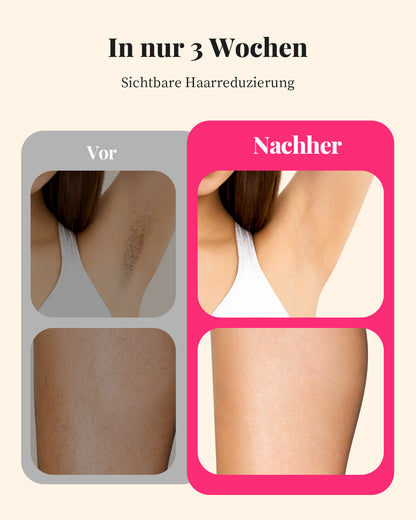 Haarlosy IPL Geräte Haarentfernung Laser Haarentfernungsgerät Frauen Männer
