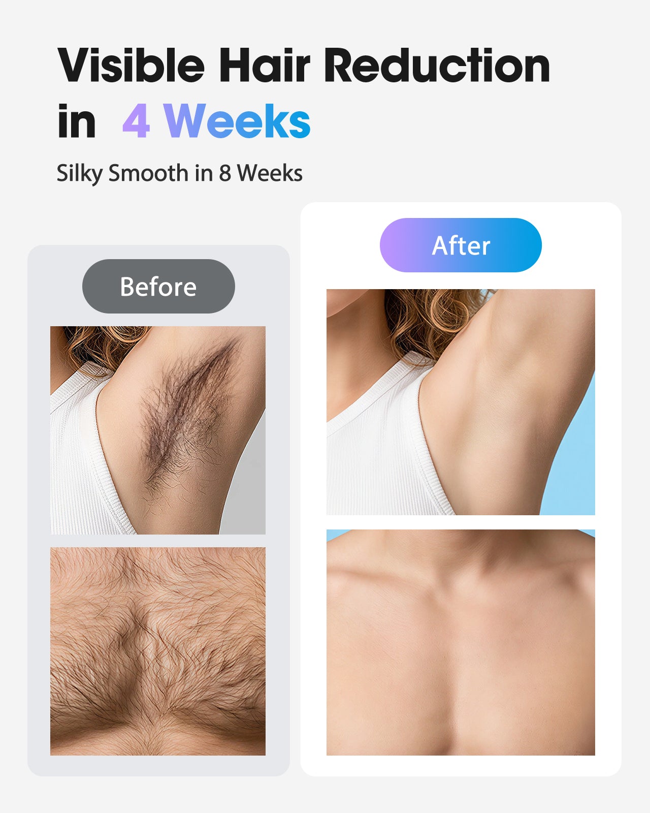 Haarlosy IPL Laser Hair Removal Device for Women and Men with Ice Cooling Painless Salon Quality Result at Home, Lazer Hair Remover for Face Bikini Line Body, 5 Levels, 999,900 Flash Light