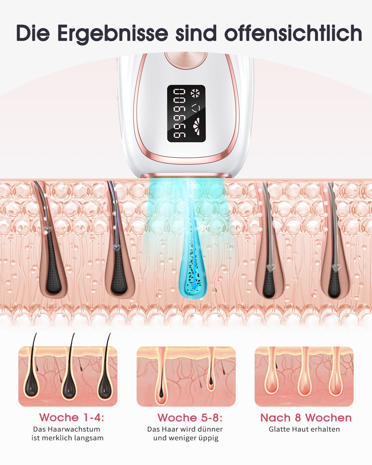 Haarlosy IPL Geräte Haarentfernung Laser mit Gefrierfunktion, Schmerzfreie 5 Energiestufen 999,900 Lichtimpulse Haarentfernungsgerät für Damen Männer Gesicht Achseln Beine und Körper