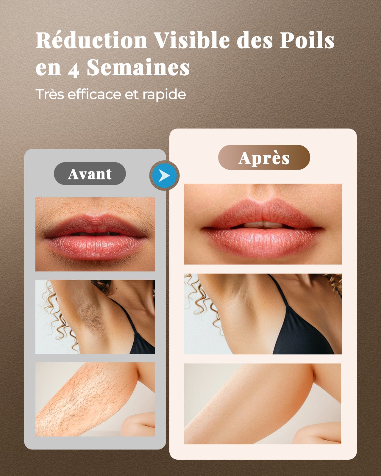 Haarlosy Épilateur Lumière Pulsée, Grande Fenêtre 5 cm², 999,900 Flashs IPL, 9 Niveaux & 2 Modes, Auto/Manuel – Épilation Laser Définitive Maison Femme & Homme, Visage, Corps, Aisselles, Bikini