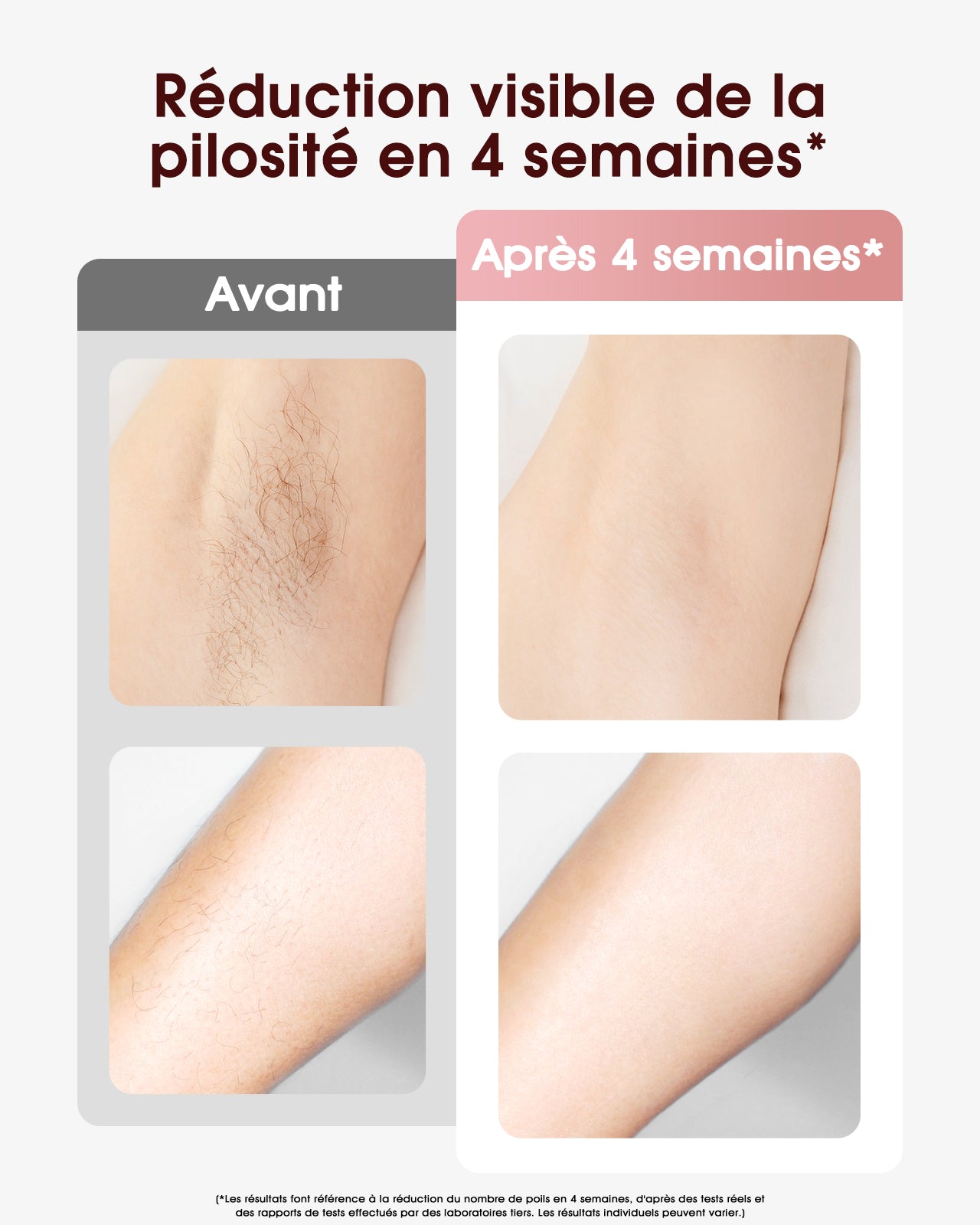 Haarlosy Épilateur Lumière Pulsée de Refroidissement, 999,900 Flashes IPL Laser Épilateur Definitive, 2 Modes 5 Niveaux Énergie Épilation Laser pour Visage/Corps/Maillot/Aisselles