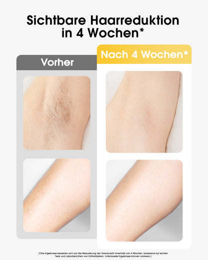 Haarlosy IPL Geräte Haarentfernung mit Kühlfunktion, 999,900 Lichtimpulse, 5 Energiestufen Schmerzfreie IPL Haarentfernung Laser Hair Removal für Frauen, Männer, Intimbereich, Körper und Beine